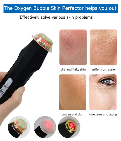 Oxygen Pen 1